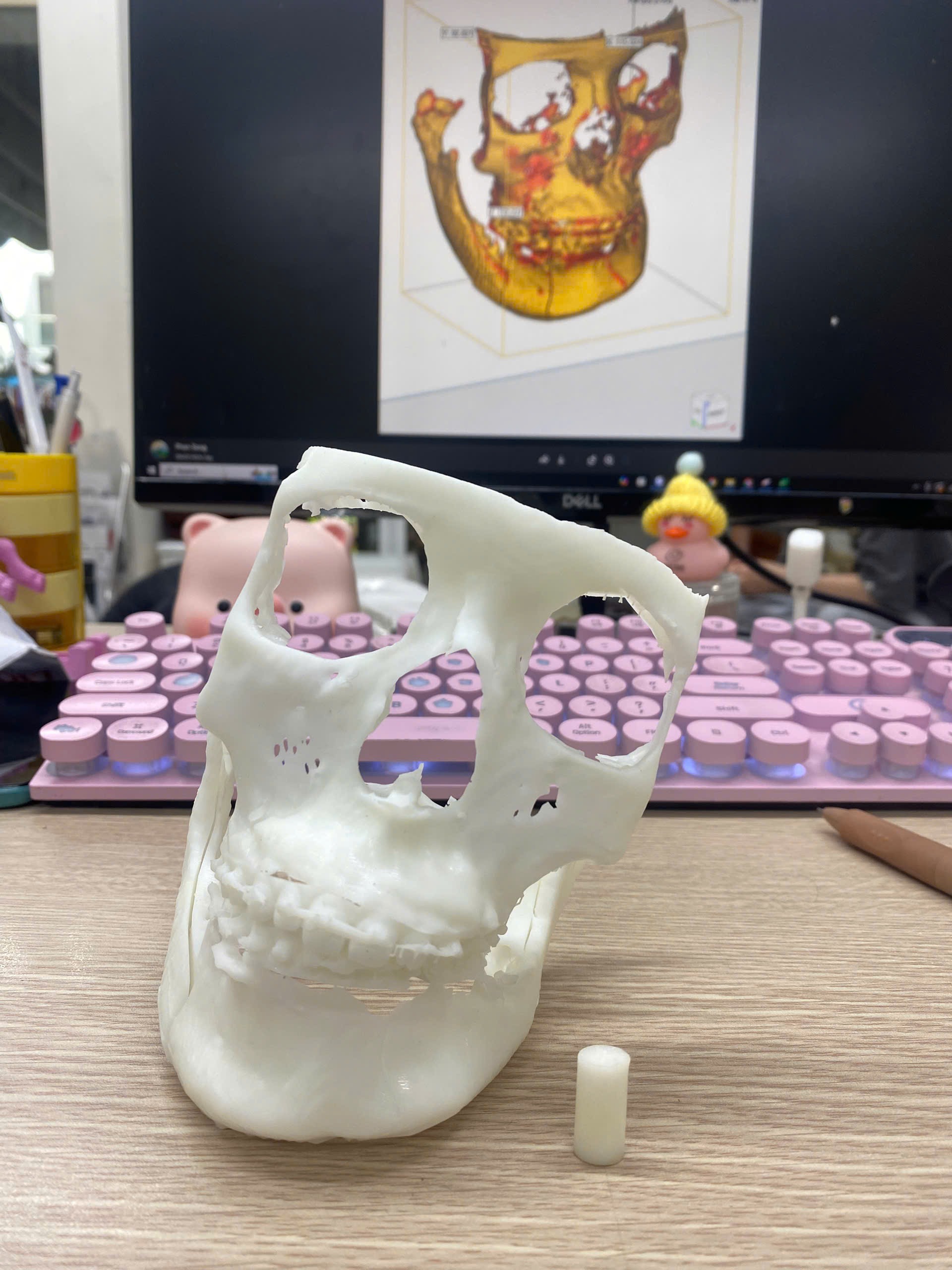 Ứng dụng công nghệ in 3D trong lĩnh vực y tế