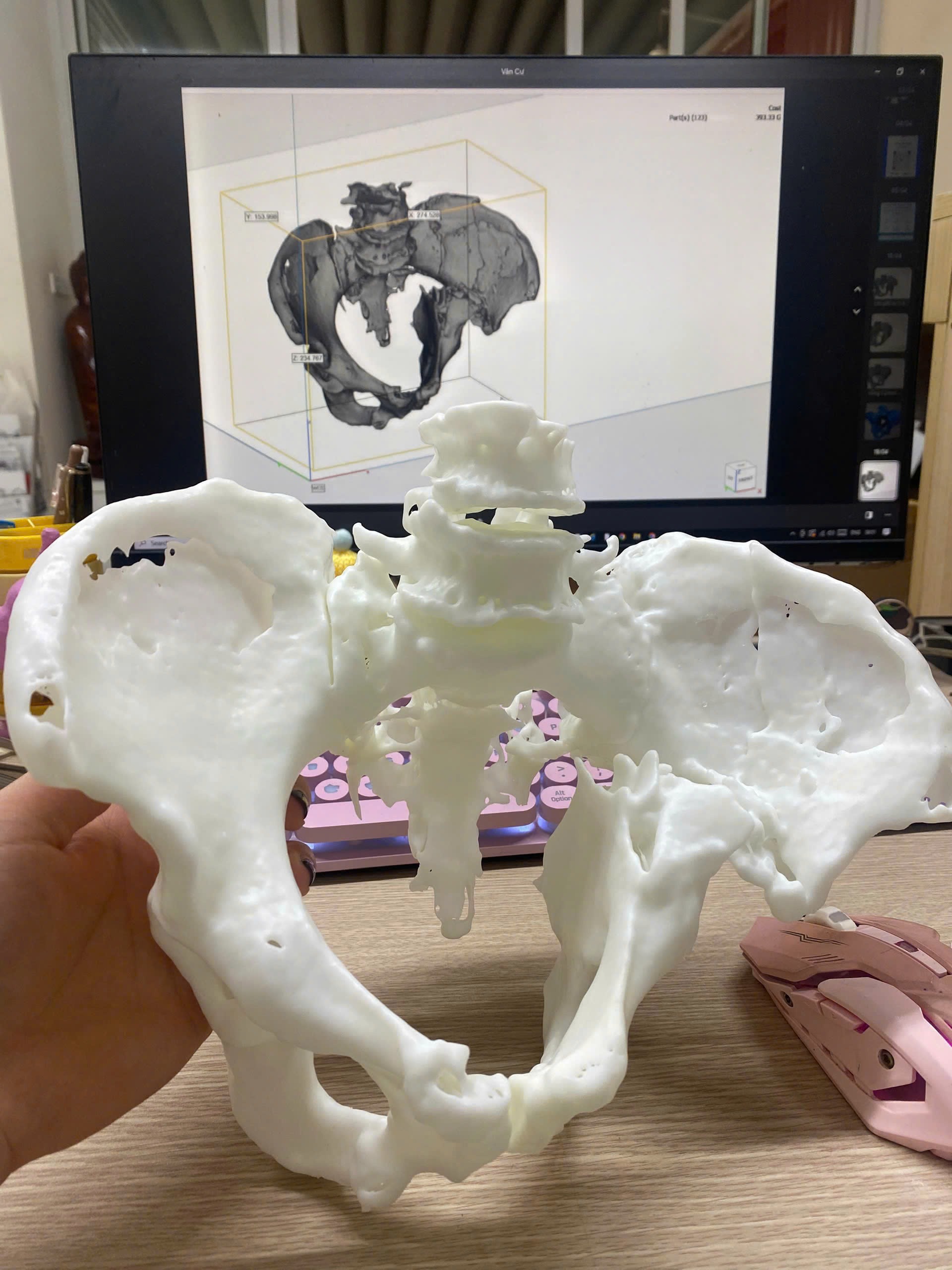 Ứng dụng công nghệ in 3D trong lĩnh vực y tế